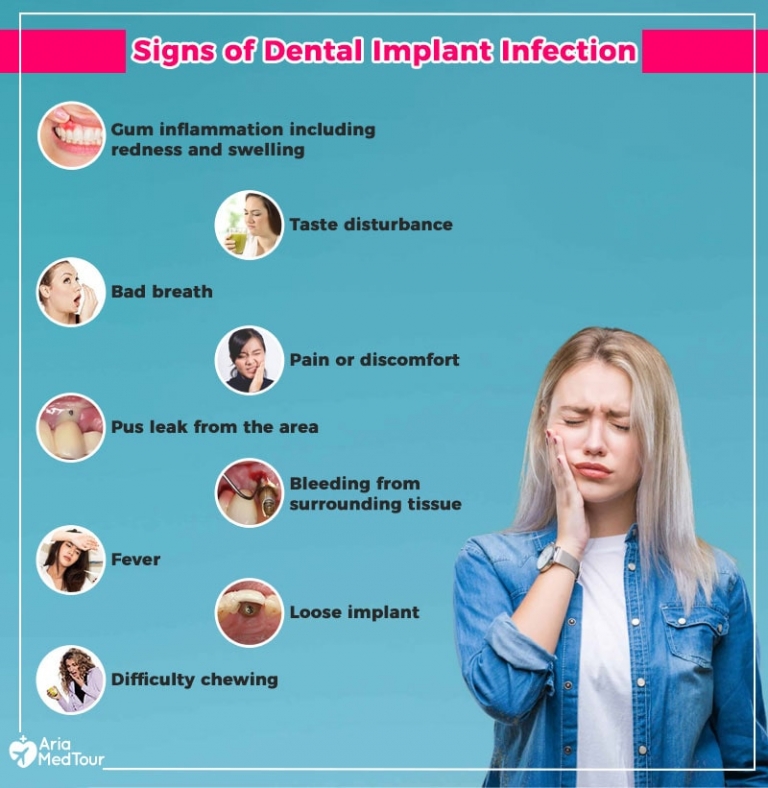 Dental Implant Infection Causes, Prevention and Treatments