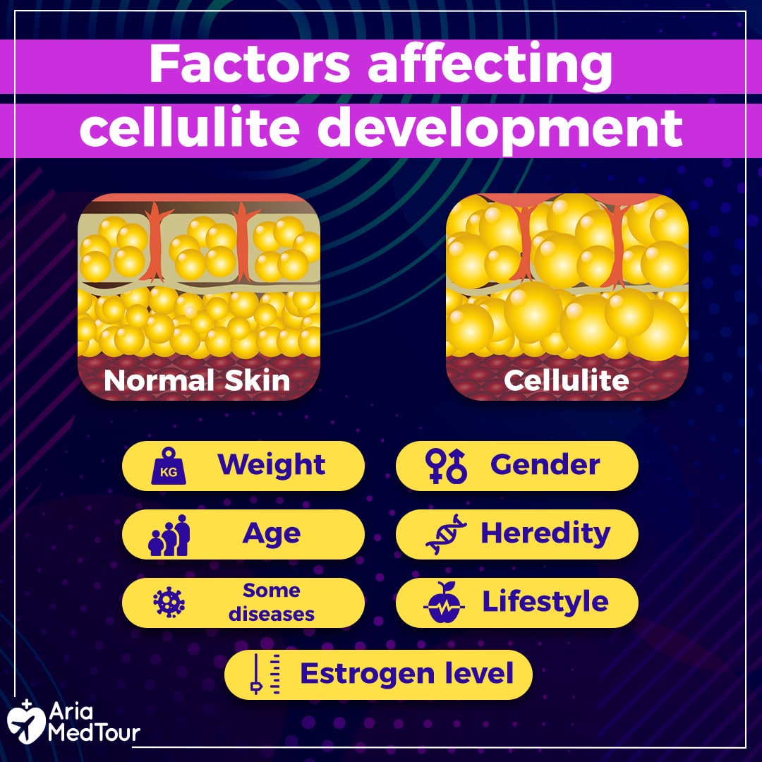 cellulite causes and factors