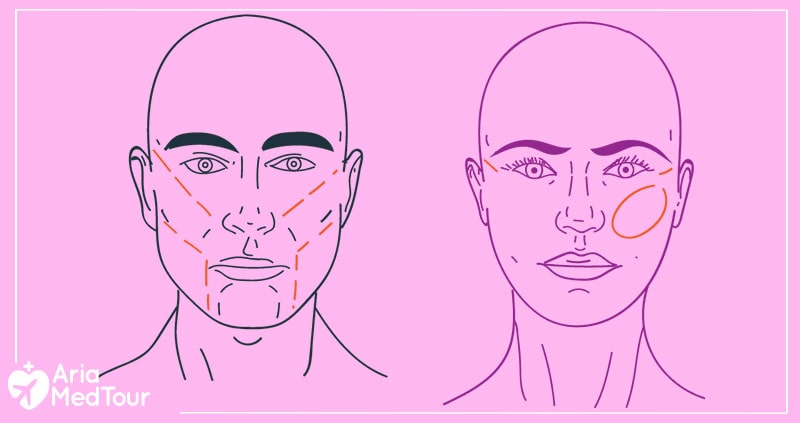 differences between a male and a female cheeks and cheekbones