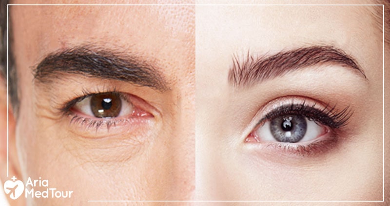 differences between a male and a female eyes and eyebrows