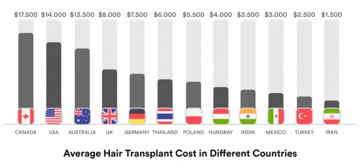 Hair Transplant In Iran Best Surgeons And Clinics Ariamedtour 7901