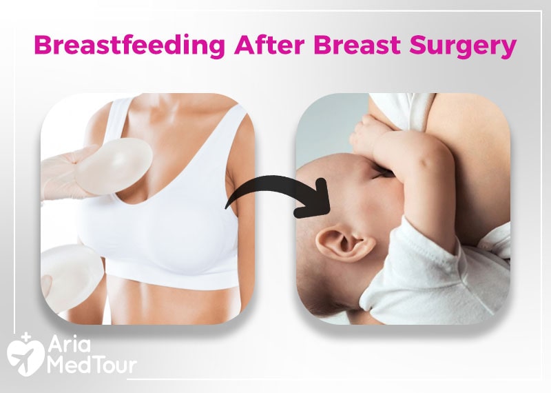breastfeeding after breast surgery: can i breastfeed after different types of breast surgery?