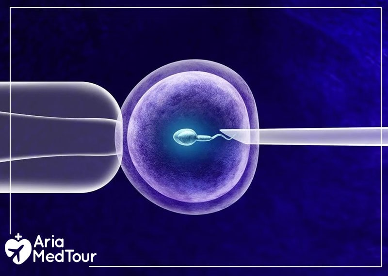 Schematic photo of IVF process